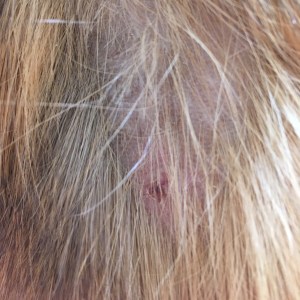 Morag's mite hair loss.